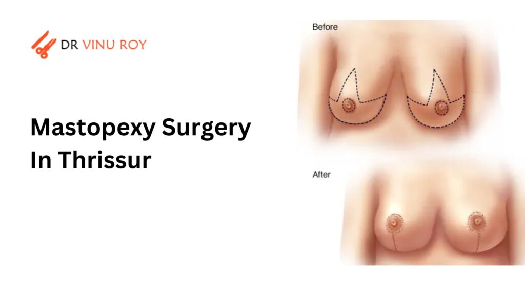 mastopexy surgery in Thrissur