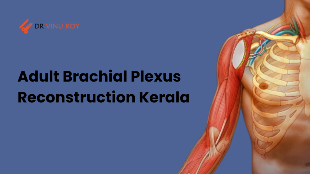 adult brachial plexus reconstruction Kerala