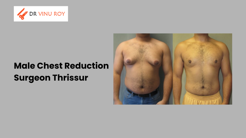 Male Chest Reduction Surgeon