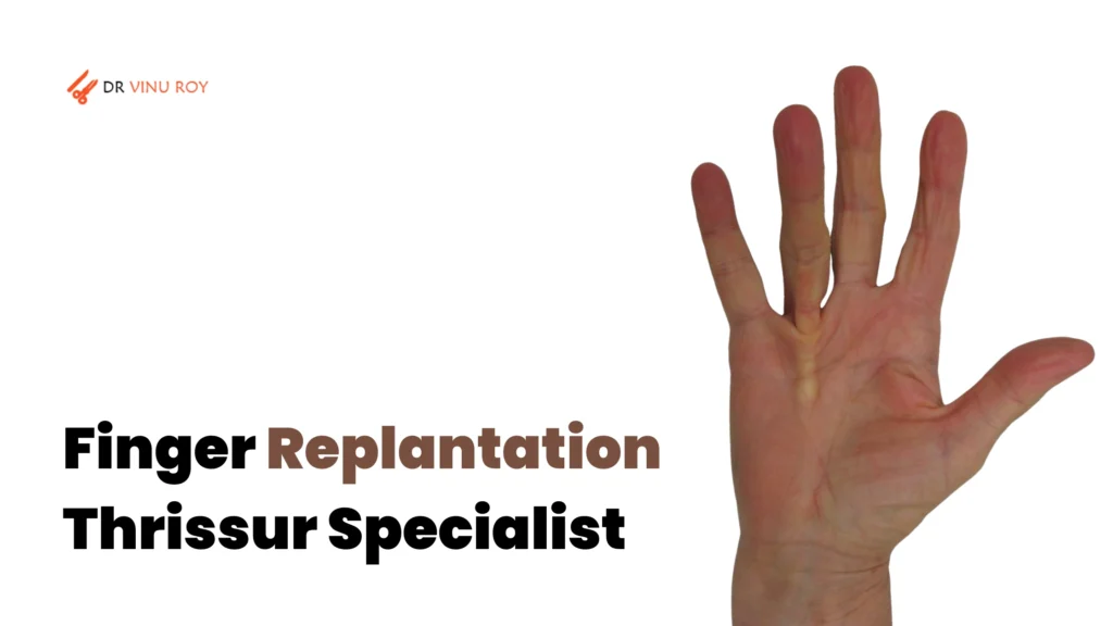 finger replantation Thrissur specialist