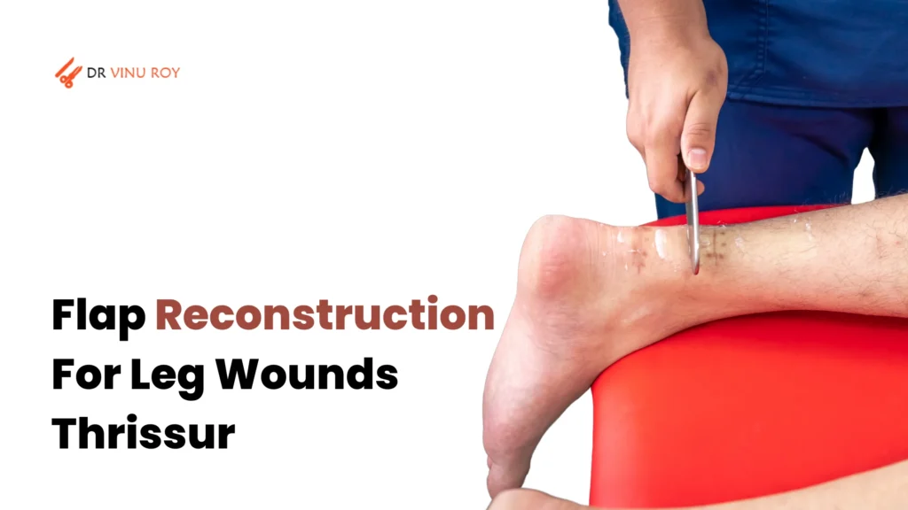 Flap Reconstruction For Leg Wounds Thrissur