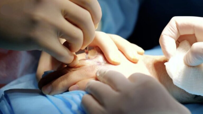Surgeon performing hand surgery with suturing under sterile conditions