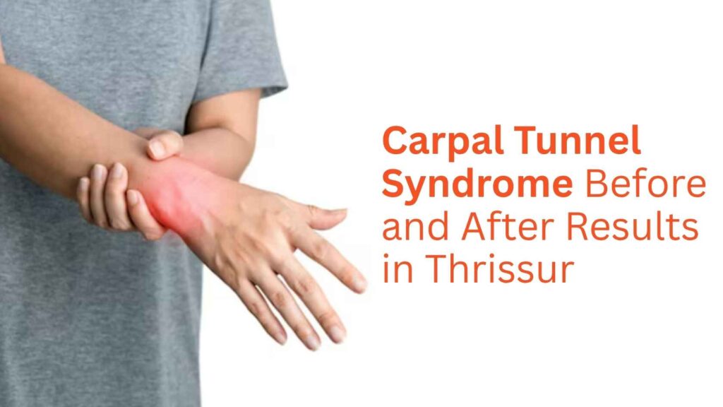 Person holding wrist with pain highlighting carpal tunnel syndrome before and after results in Thrissur.