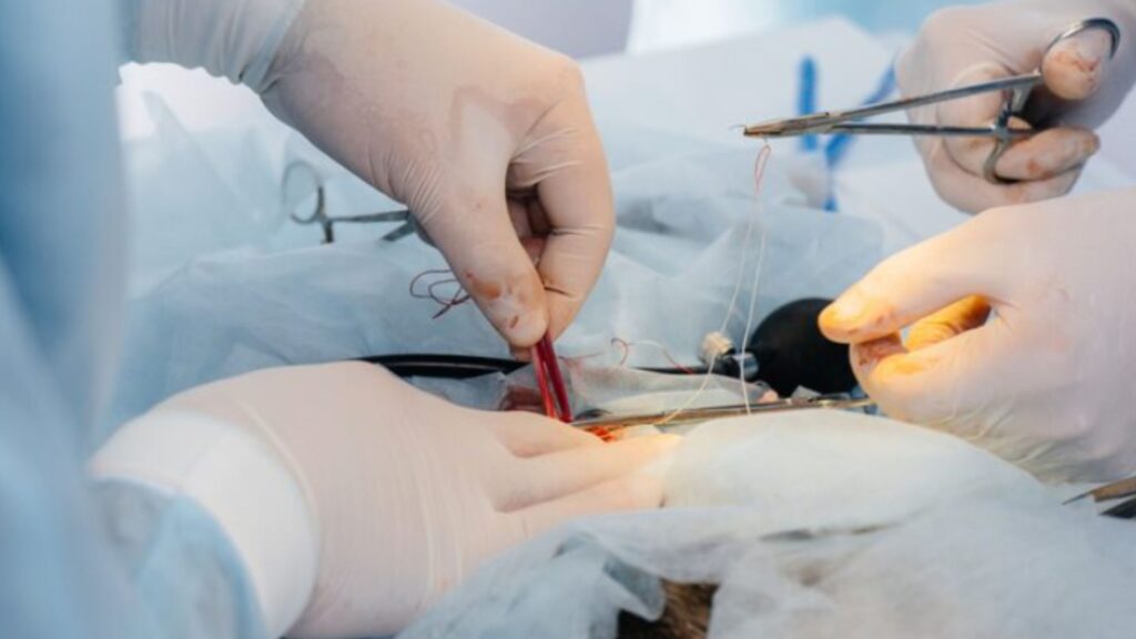 Microvascular Surgery in Thrissur showing surgeons performing a precise surgical procedure using fine instruments and magnification techniques